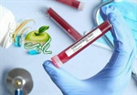 💉 همه بهبود یافتگان کرونا آنتی بادی بالا ندارند